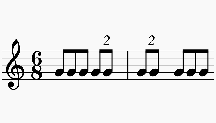 The Main Types of Notes in Music (Music Theory 101)
